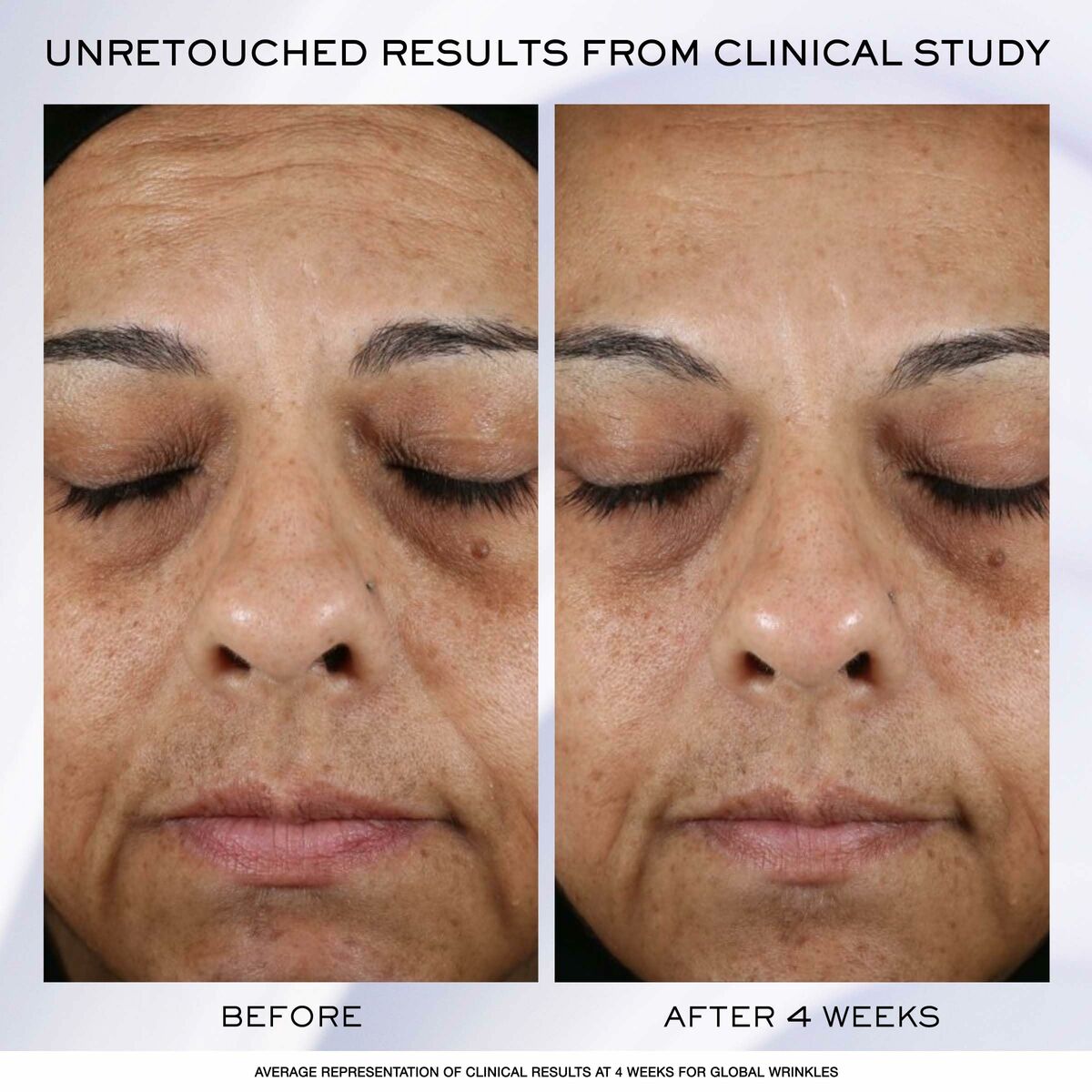 Crema de Día Lancôme Rénérgie Lift Ultra 50 ml