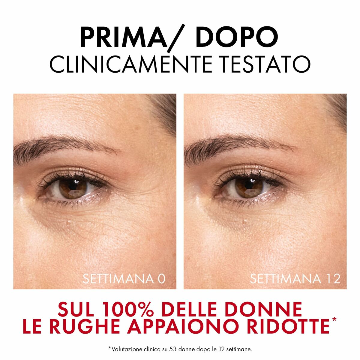 Sérum Facial Vichy LIFTACTIV 30 ml