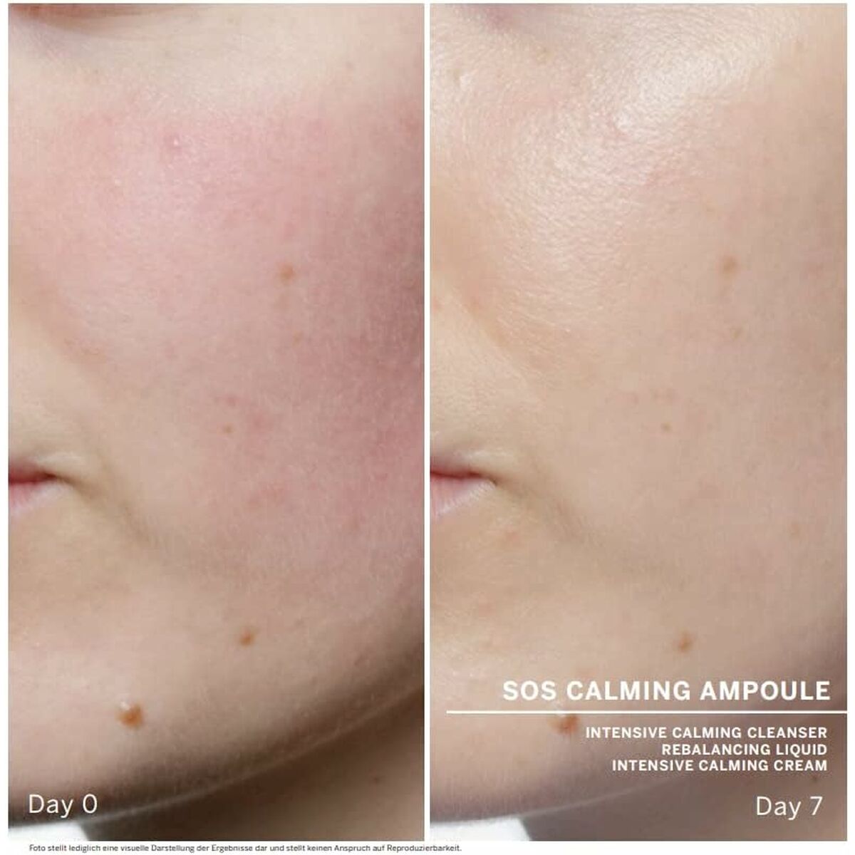 Tratamiento Facial Babor Sos Calming