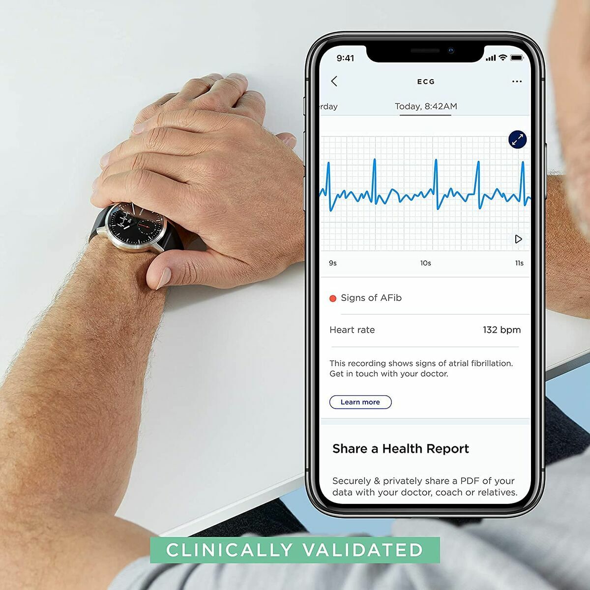 Smartwatch Fitbit Versa 4 Rosa 1,58"