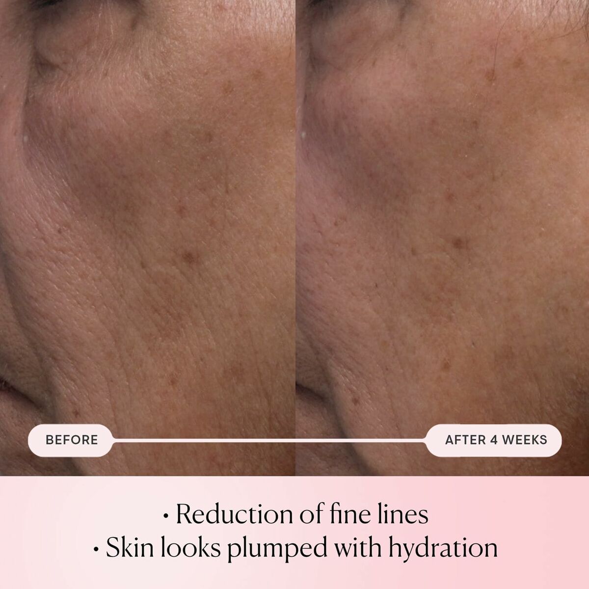 Sérum Facial Elemis