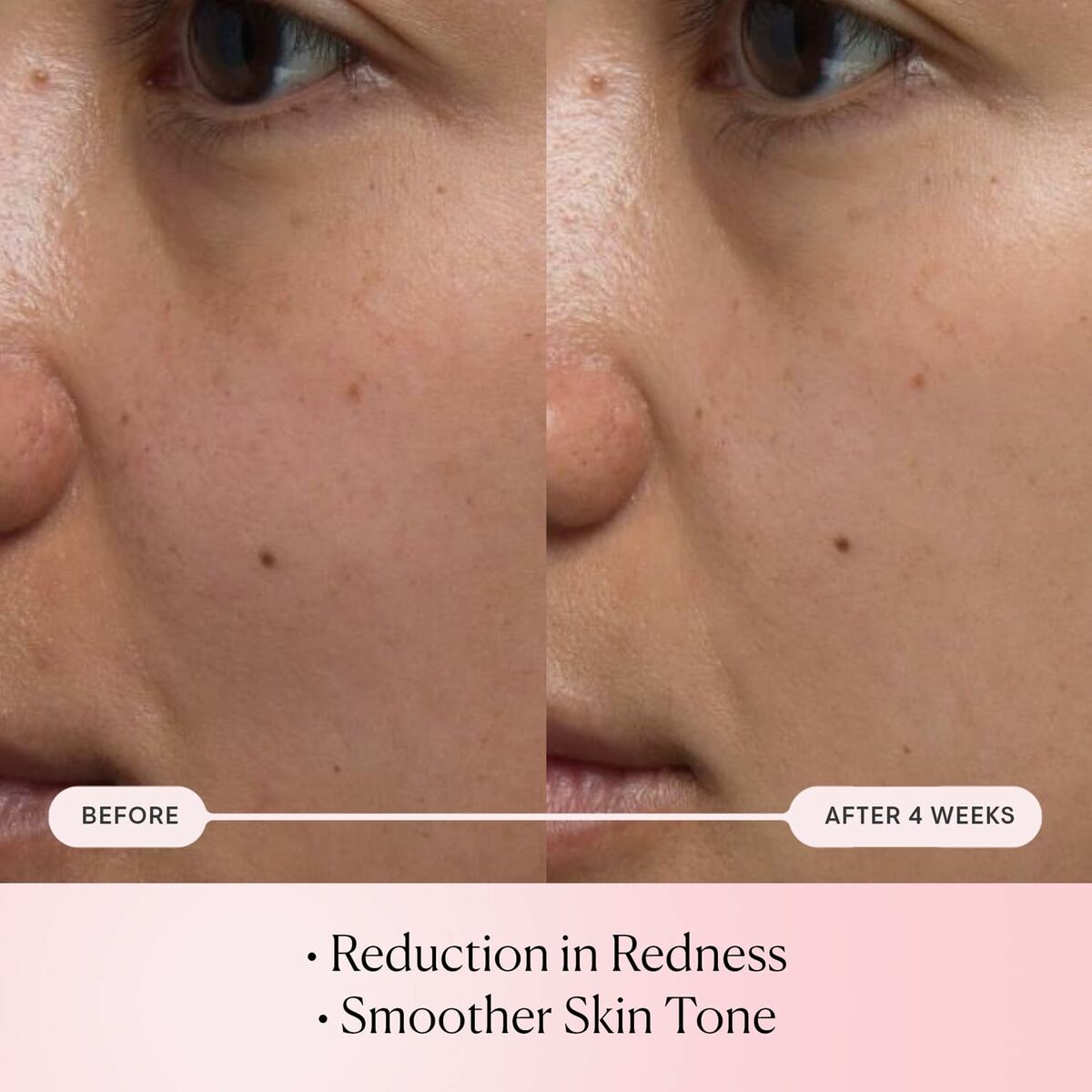 Sérum Facial Elemis