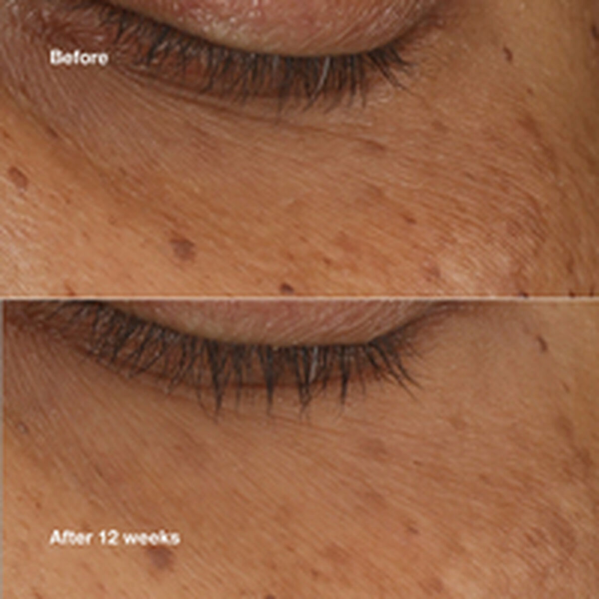 Sérum Iluminador Clinique ALL ABOUT EYES 10 ml